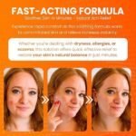 Hydrocortisone Ointment | 1oz Hydrocortisone Ointment with 1 Percent USP – Maximum Strength